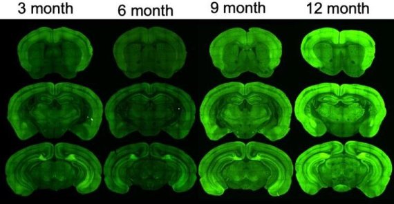 한국과학기술연구원 치매DTC융합연구단 김윤경, 임성수 박사 연구팀이 개발한 치매모델 실험쥐는 타우 단백질이 뭉쳐지면 형광물질이 작용해 초기단계부터 관찰할 수 있다.