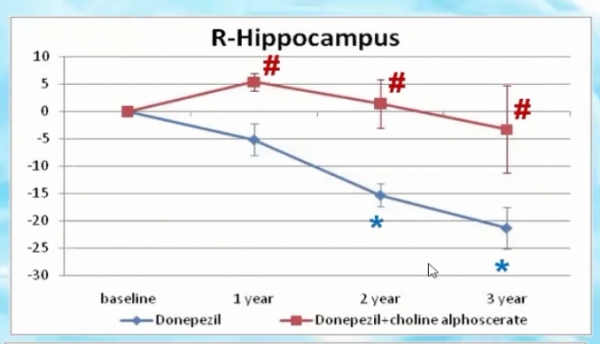 도네페질 단독 투여군과 도네페질-콜린 알포세레이트 병용 투여군의 뇌 해마 축소 비교