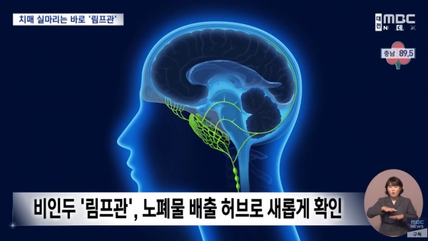 치매 해결할 실마리 '림프관서 찾았다' / 2024.01.11. 뉴스데스크 대전MBC