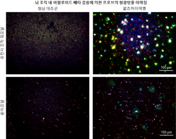 뇌 조직에서의 정상 대조군 비교를 통한 알츠하이머병 모델의 형광 신호 / 조선대 치매국책연구단