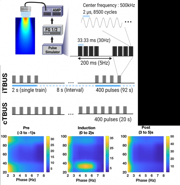 초음파 실험의 기본적인 패러다임과 동기화된 뇌파 그래프 / IBS