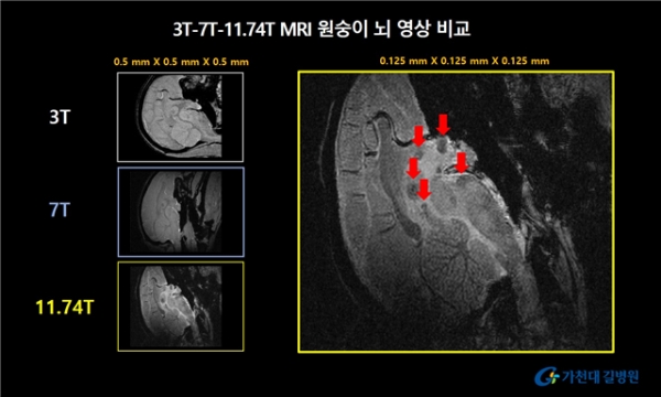 11.74T MRI로 해상도를 0.125mm까지 높인 영상에서 기존 MRI 영상에서는 확인하기 어렵던 세포핵(화살표 표기) 더욱 선명하게 확인 가능하다. / 가천대 제공