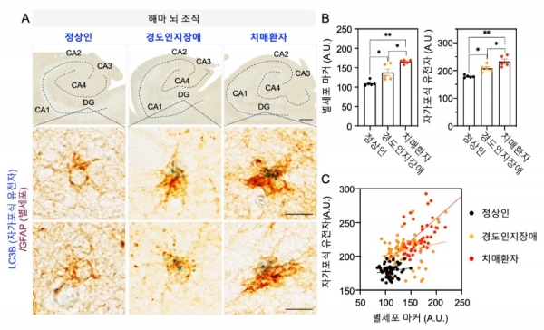치매 환자 뇌 조직에서 성상교세포 특이적으로 자가포식 유전자의 발현 증가 양상을 확인함 / KIST