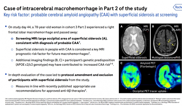 로슈 발표 자료