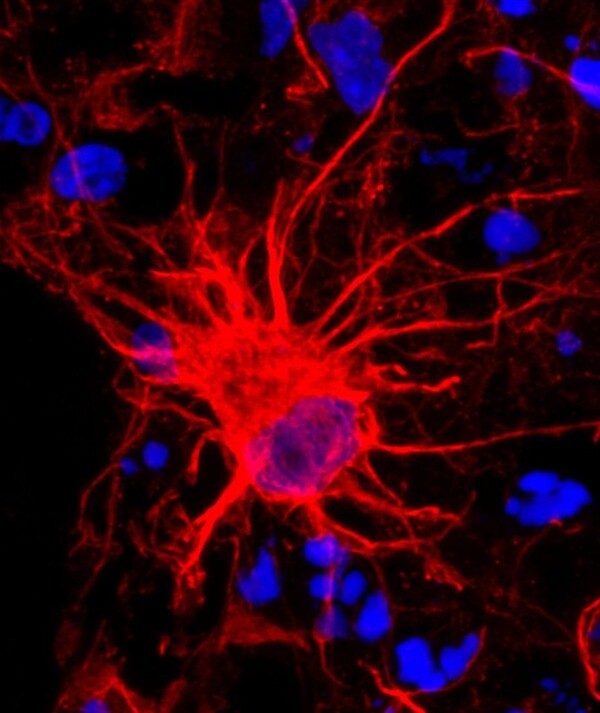 Star shaped brain cells(astrocytes), NIH