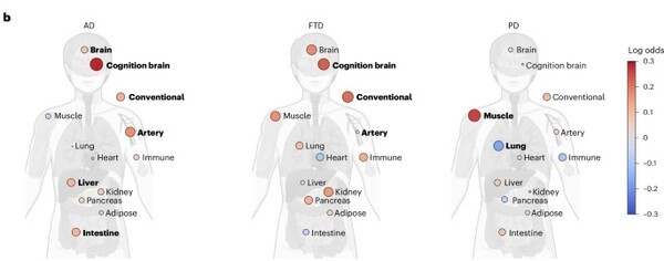 AD, FTD, PD 질환군에서 질환별로 단백체 노화에 영향을 많이 받는 장기 시각화 지도. 질환군별로 단백질 발현 패턴이 두드러진 장기를 색상으로 표현했으며, 붉은색은 질병에 영향을 더 많이 받는 장기를 나타낸다. / Imam F, et al. Nature Medicine. 2025; doi:10.1038/s41591-025-03834-0. Figure 2b. © 2025 Springer Nature. Reprinted with permission.