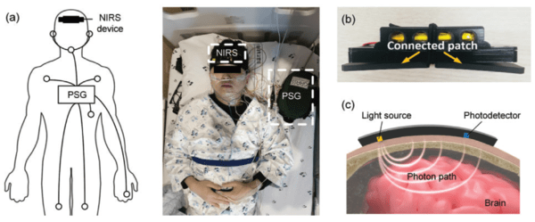 연구팀이 개발한 무선 근적외선 분광기로 이마에 부착해 수면 중 뇌 수분량을 측정하면 아교임파계 활성도를 확인할 수 있다. / 분당서울대학교병원