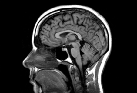 보건복지부 국립정신건강센터 홈페이지