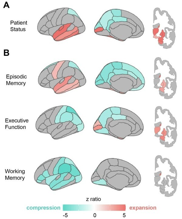 Age-related constraints on the spatial geometry of the brain(Nature Communications, 2025)